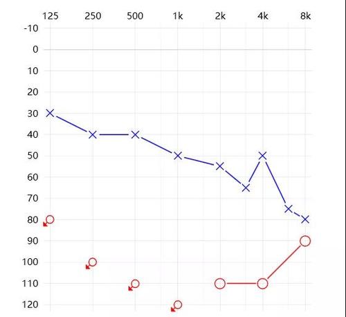 不对称听力损失，如何解决？ - 杭州汇听科技有限公司